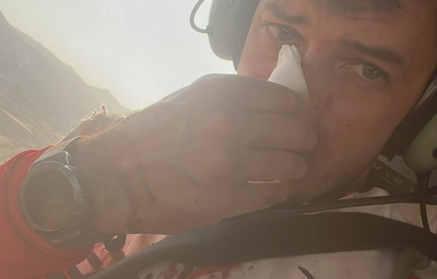 James Hillier with a broken nose on the 2025 Dakar Rally. Credit: Instagram/James Hillier.