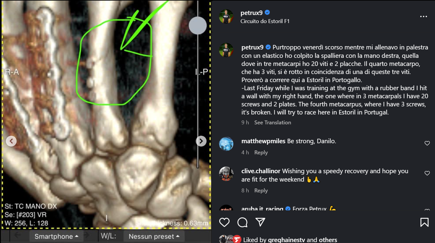 Danilo Petrucci's hand injury (Instagram)