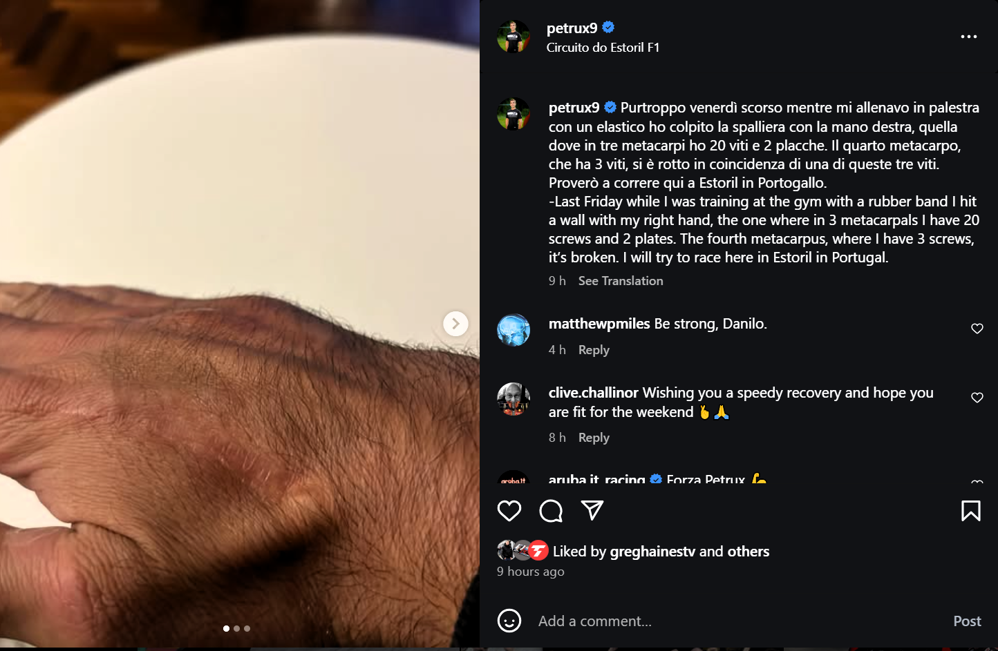 Danilo Petrucci's hand injury (Instagram)