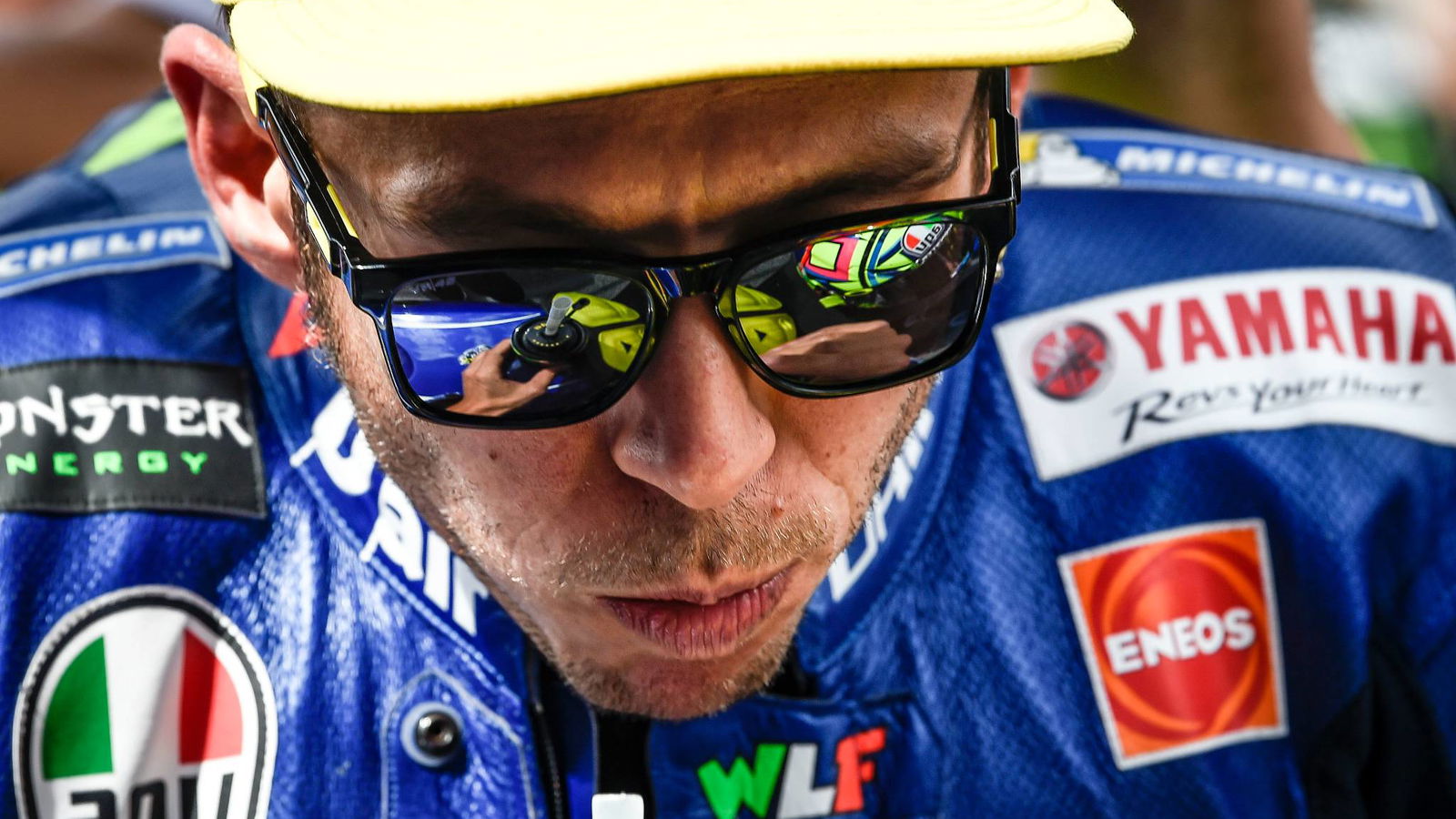 Rossi undergoes surgery, aims to be back ‘as soon as possible’