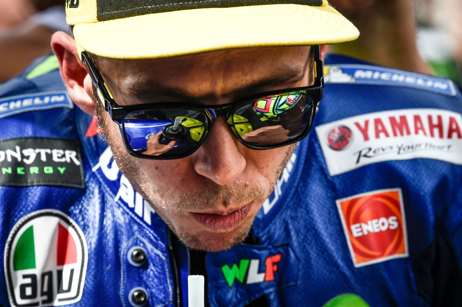 Rossi injuries confirmed, will undergo surgery