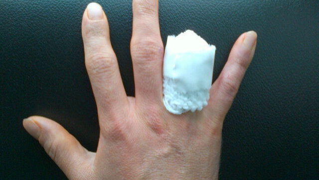 John Hopkins opts for finger amputation