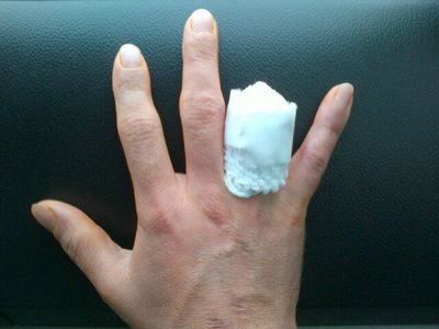 John Hopkins opts for finger amputation