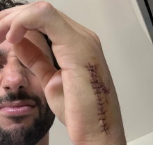 Daniel Ricciardo displays massive post-surgery wound